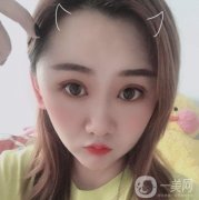 做完拉皮手術已經(jīng)有兩個月的時間了，大家看一下，我是不是有了大的變化