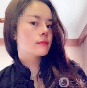 電波拉皮去頸紋第三天，并沒有感覺到不舒服，我現(xiàn)在只要一有時間就照鏡子