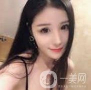 玻尿酸注射后的第一天，很好看，我是那種追求小V的女生
