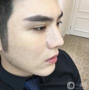 鼻子不好看經(jīng)過長時間的心里斗爭，終我下定決心改變自己