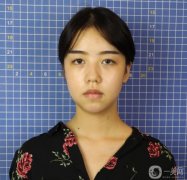 鼻子拆線了,恢復(fù)得很好,形狀也已經(jīng)出來了
