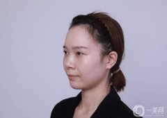 我的鼻子一點(diǎn)都不立體,早就想弄鼻子了