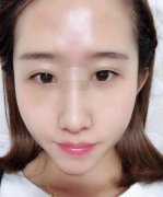 一直對(duì)自己的鼻子不滿(mǎn)意,雖然挺高，但是肉多