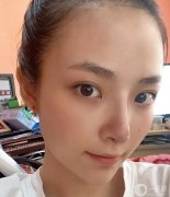 雖然從小到大的朋友都說我長得好看，但我總是對自己的鼻子不滿意