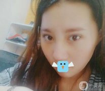 我一直想做鼻子，但是我的鼻子太差了，很難讓它好看