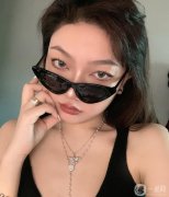 手術前，我的鼻子很大，山根塌了，側面看起來像狗鼻子