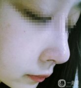 據(jù)說只有鼻子小的人才稱得上美女