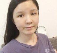 臉部的腫脹正在慢慢減輕，淤青也在消失，越來越正常