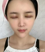 單眼皮可以說是很多女生面值里的一大BUG