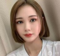 后來知道了整形醫(yī)院，一開始對切開雙眼皮有點抵觸，有點害怕