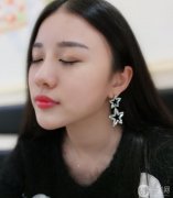 因?yàn)槲业哪槻皇呛芰Ⅲw，醫(yī)生也建議我在打填一個玻尿酸