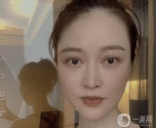 我見(jiàn)到了醫(yī)生，醫(yī)生給我開(kāi)了外切去眼袋手術(shù)