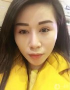 一直想做雙眼皮手術(shù)，但還是猶豫不決，因?yàn)檫@雖然是小手術(shù)，但畢竟還是在臉