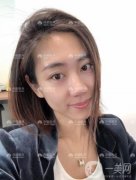 雖然現(xiàn)在做雙眼皮手術(shù)不是什么大手術(shù)，甚至可以說十有八九做了雙眼皮