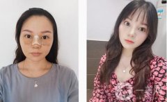 鼻梁很低，鼻翼很寬，從正面和側(cè)面看，這都是一個(gè)合適的塌鼻子