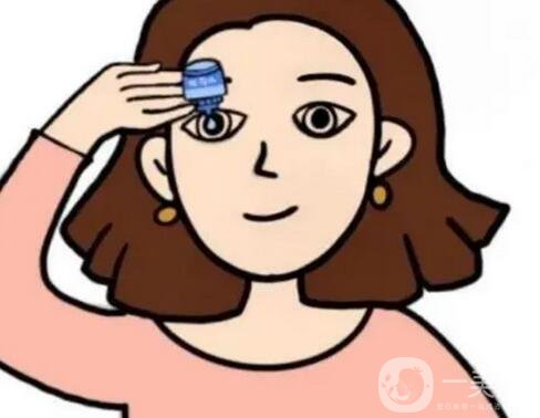  割雙眼皮前后圖