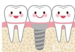 秦皇島種植牙多少錢一顆？價格費用受哪些因素影響？戳這里了解