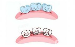 安徽矯正牙齒要多少錢？矯正牙齒的佳年齡分享