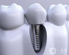 襄陽種牙多少錢一顆啊？種植體品牌+價格介紹，口碑醫(yī)院推薦