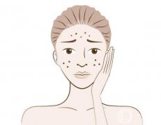 凹陷疤痕修復(fù)手術(shù)一般多少錢？技術(shù)好的醫(yī)院盤點(diǎn)、對比分享