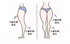 抽脂減肥價(jià)格一覽表2024，抽脂減肥安全性一次了解