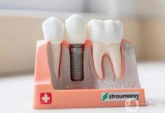 珠海種植牙多少錢一顆？2024珠海便宜又好牙科機(jī)構(gòu)推薦