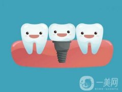溫州種植牙一顆要多少錢？價格收費標(biāo)準(zhǔn)/正規(guī)牙科機(jī)構(gòu)一覽