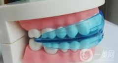 大連牙齒矯正大概要花費多少錢？收費標(biāo)準(zhǔn)+正規(guī)牙科機(jī)構(gòu)一覽