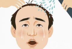 植發(fā)費(fèi)用大揭秘：這些因素讓你不花冤枉錢！