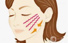 上海張曉建醫(yī)生拉皮多少錢？手術(shù)價格、醫(yī)生簡介、口碑大測評