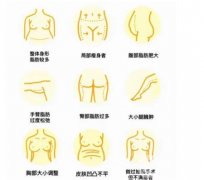 水動力吸脂減肥怎么樣