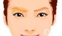 提眉手術(shù)的風險有哪些