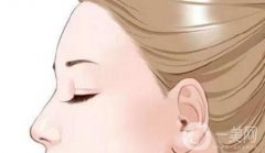 提眉手術(shù)與雙眼皮手術(shù)需要間隔多久？