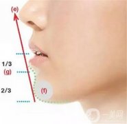 下巴注射玻尿酸后如何快速恢復(fù)呢？