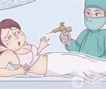 夏天抽脂是否更有利于恢復？