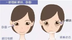 眼袋修復(fù)的方法有哪些？