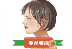 有哪些矯正鼻骨的方法呢？