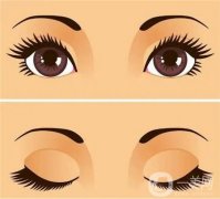 眼窩填充是否需要手術呢？