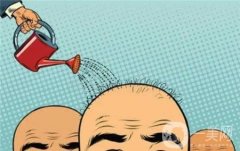 植發(fā)術后有什么副作用