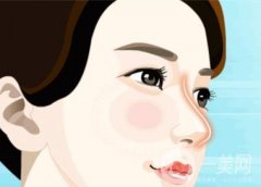 自體軟骨隆鼻的方法及優(yōu)點(diǎn)