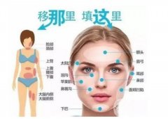 自體脂肪填充額頭有什么缺點(diǎn)？