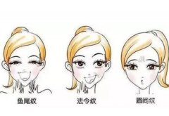 做線雕蛋白線如何呢？