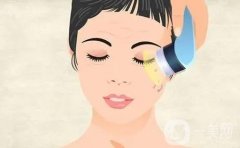 做光子肌膚好還是果酸好