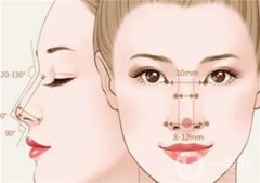 隆鼻假體取出后的的護(hù)理方法