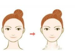 切骨手術(shù)怎么樣，有潛在風(fēng)險(xiǎn)嗎