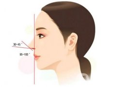 膨體隆鼻后取出是否真的困難？