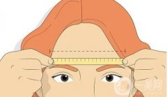 切眉手術的注意事項有哪些