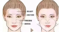 切眉術后的護理與注意事項