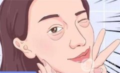 祛除眼袋手術后多久可以拆線