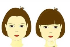 顴骨墊高手術(shù)的效果如何，恢復(fù)時(shí)間長嗎